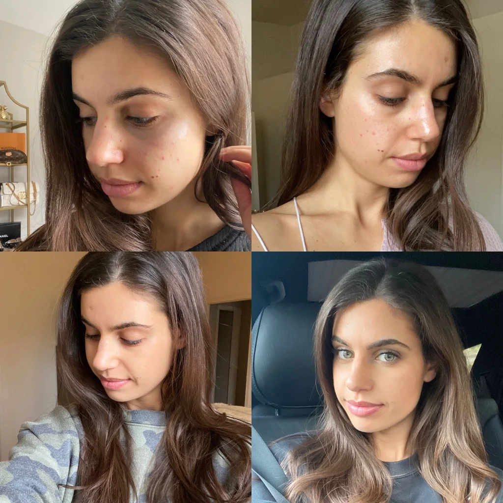 My Skincare Journey?